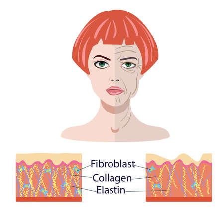 Vector face and two types of skin - aged and young for medical and cosmetological illustrations isolatedのイラスト素材