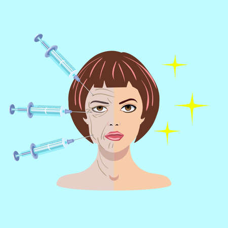 Vector illustration with dermal filler process on the blue background with woman's face and injectionのイラスト素材