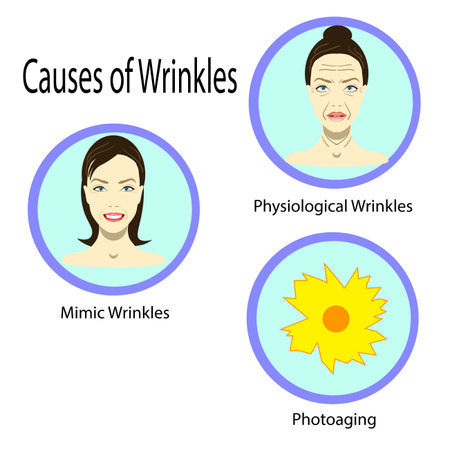 Causes of aging, vector illustration reasons of aging, types of wrinkles on the white backgroundのイラスト素材