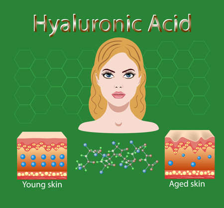 Vector illustration with process of getting skin old because of lack of hyaluronic acid isolatedのイラスト素材