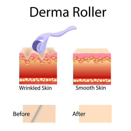 Mesorolling process and cell structure, before after effect isolatedのイラスト素材