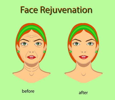 Face rejuvenation, vector illustration with before after effect isolatedのイラスト素材