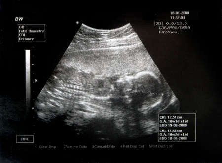  Baby inside the belly of her motherの写真素材