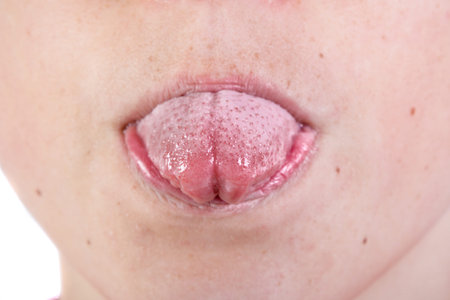 Close up of a young caucasian teenage boy's face