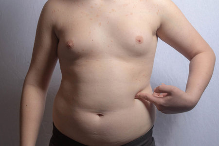 An overweight caucasian teenage boy showing his stomach while standingの写真素材