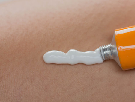 Topical pain in the leg