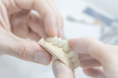 Medical tooth dental technician holding prosthetic in laboratoryの写真素材