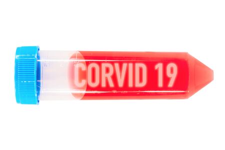 Tube of blood with positive analysis report from CORVID 19. Coronavirus epidemic, quarantine for public health from infections, virus test and research concept. Positive Coronavirus test blood sample.の写真素材