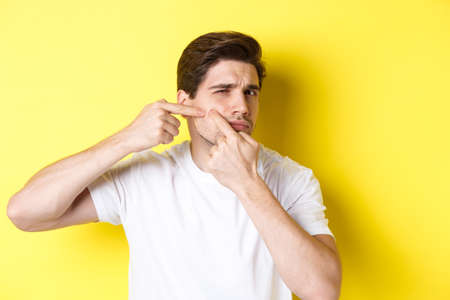 Young man pop a pimple on cheek, standing over yellow background. Concept of skin care and acneの写真素材