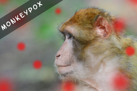 Monkeypox outbreak, MPXV virus, infectious disease spreading, sick monkey