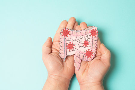 Colon digestive system with EHEC bacterial disease, enterohemorrhagic Escherichia coli, shigatoxigenic and verotoxigenic, bloody diarrhea, foodborne illness, infecting intestineの写真素材