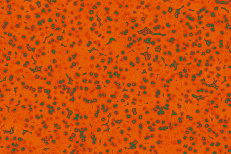 Shape of bacterial cell: cocci, bacilli, spirilla bacteria background