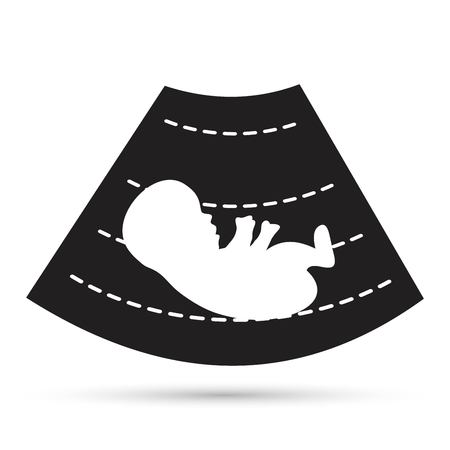Ultrasonography baby icon. Screening baby.のイラスト素材