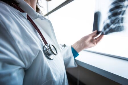 Female  doctor checking xray image of lungs.の写真素材