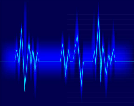 Electrocardiogramのイラスト素材