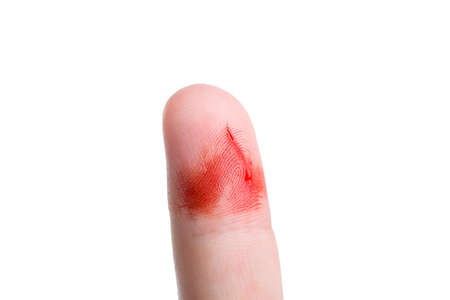 forefinger in streaks of blood with a cut a consequence of skin damage and open bleeding from a scratch on the body close-up isolated on a white background.の写真素材