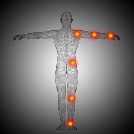 Conceptual wireframe human or man anatomy body with joint painの写真素材