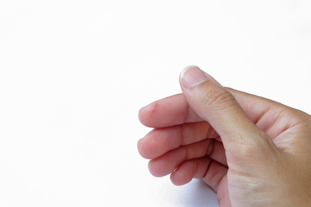 knife cut wound on hand at upper part of forefinger with shadow (white background)の写真素材