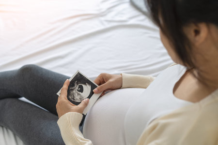 Pregnant woman looking at baby ultrasound scan. Mom is happily looking at the ultrasound picture of...