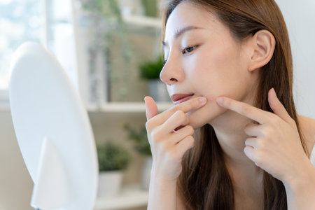 Asian teenage women are worried about acne on faces,Look in the mirror and squeeze the pimple out. hormone acne, inflammatory acneの写真素材