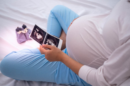 A pregnant woman is looking at an ultrasound photo of fetus. Mother gently touches the baby on stomach.Women are pregnant for 30 weeks. first love in belly and Last term pregnancyの素材 [FY310193454796]