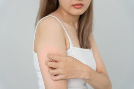 skin problem and beauty. Young woman scratch body has itchy skin from skin allergic, steroid...