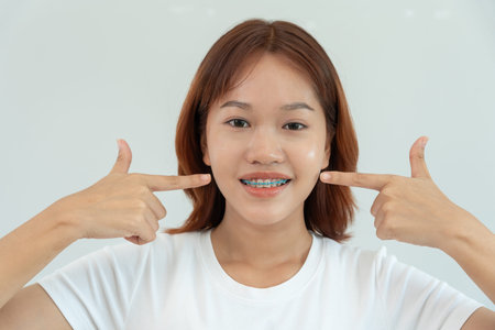 Treatment. Dental Care. Beautiful asian Woman Healthy Smile.Metal Brackets on Teeth. young Female...