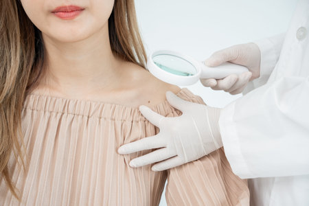 skin problem and beauty of asian girl. Dermatologist use magnifying glass look itchy skin from skin...