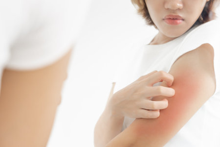 skin problem and beauty. Young woman scratch body has itchy skin from skin allergic, steroid...
