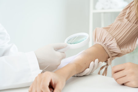skin problem and beauty of asian girl. Dermatologist use magnifying glass look itchy skin from skin allergic, steroid allergy, sensitive skin, chemical allergy, rash, insect bites, Dermatitis.の写真素材