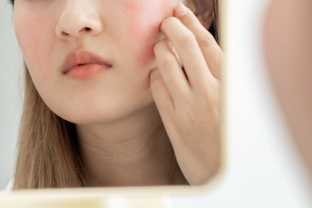woman asian are worried about faces Dermatology and allergic to steroids in cosmetics. sensitive skin, red face from sunburn, acne, allergic to chemicals, rash on face. skin problems and beautyの写真素材