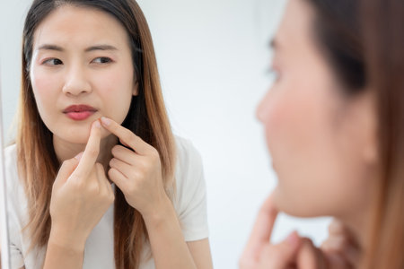 Woman worried about face Dermatology, rosacea dermatitis, allergic steroids, sensitive skin, red face from sunburn, acne, dry skin, large pores ,rash face, dull, freckles, wrinkle, skin problem, beautyの写真素材