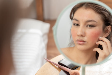 Young woman are worried about faces Dermatology and allergic to steroids in cosmetics. sensitive skin, red face from sunburn, acne, allergic to chemicals, rash on face. skin problems and beautyの写真素材