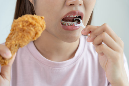 Treatment Dental Care. Woman braces use dental floss to remove food particles. Metal Brackets on Teeth. young , Care after braces, confident in orthodontics. Elimination of bad breath, tooth decayの写真素材