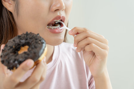 Treatment Dental Care. Woman braces use dental floss to remove food particles. Metal Brackets on...