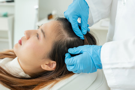 Specialist of hair recheck hair of Asian woman, damaged hair, hair loss, thinning problem, vitamin deficiency, baldness, postpartum, biotin, zinc, menstrual or endocrine disordersの写真素材