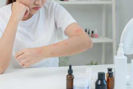 Skin and beauty problems Women have itchy skin and red rashes from cosmetic allergies, steroid...