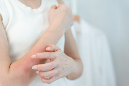 skin problem and beauty. Young woman scratch body has itchy skin from skin allergic, steroid allergy, sensitive skin, red from sunburn, chemical allergy, rash, insect bites,の写真素材