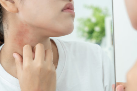 skin problem and beauty. woman scratch body has itchy skin from skin allergic, steroid allergy, sensitive skin, red from sunburn, chemical allergy, rash, insect bites, Seborrheicの写真素材