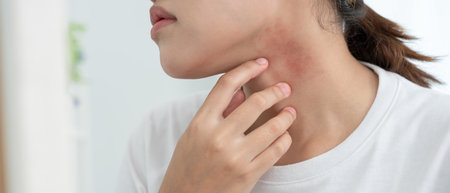 Skin and beauty problems Women have itchy skin and red rashes from cosmetic allergies, steroid allergies, sensitive skin, redness from sunlight, chemical allergies, rashesの写真素材