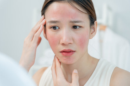 Woman worried about face Dermatology, rosacea dermatitis, allergic steroids, sensitive skin, red face from sunburn, acne, dry skin, large pores ,rash face, dull, freckles,の写真素材