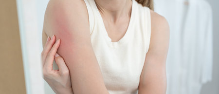 skin problem and beauty. Young woman scratch body has itchy skin from skin allergic, steroid...