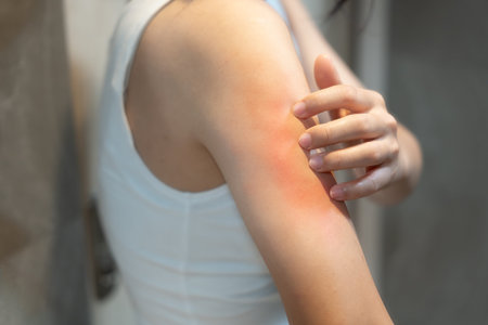 skin problem and beauty. woman scratch body has itchy skin from skin allergic, steroid allergy,...