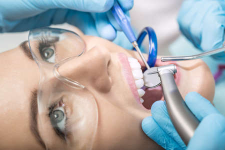 Macro photo of the teeth treatment in the dentist's office. Girl with open mouth in a protective glasses, hands in blue medical gloves with dental instruments next to her mouth. Horizontal.の写真素材
