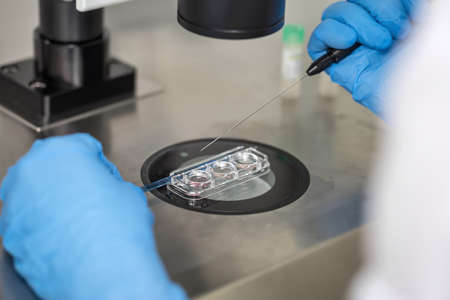 Checking result of in vitro fertilizationの写真素材
