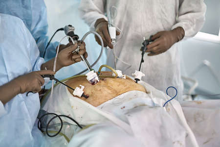 Laparoscopy operation processの写真素材