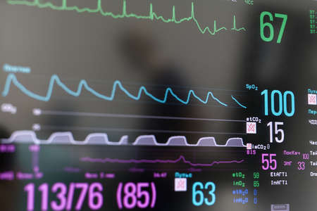Closeup photo of EKG monitorの写真素材