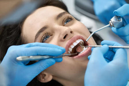 Pretty womans teeth treatment in dental clinicの写真素材