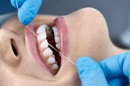 Pretty womans teeth cleaning in dental clinicの写真素材