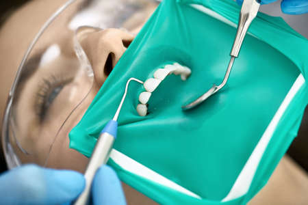 Pretty womans teeth treatment in dental clinicの写真素材